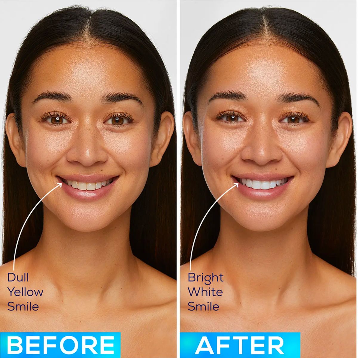 Glo Science Soler Dentistas