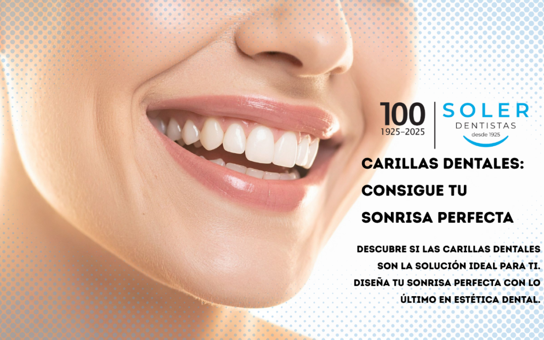 SOLER_DENTISTAS_Carillas_Esteticas