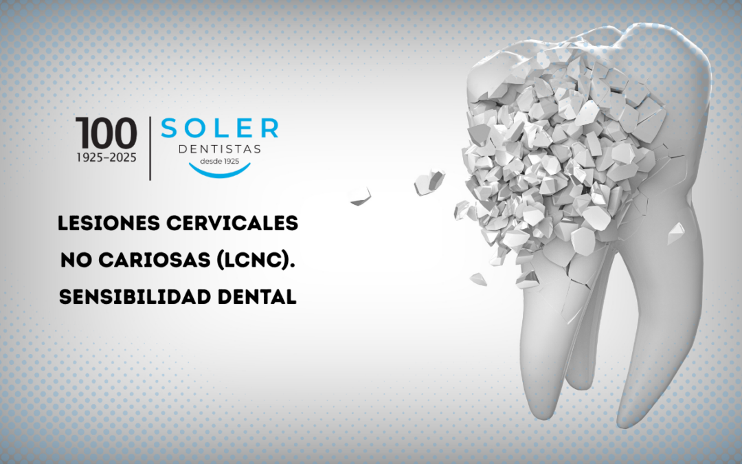 SOLER_DENTISTAS_sensibilidad